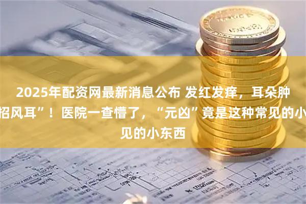 2025年配资网最新消息公布 发红发痒，耳朵肿成“招风耳”！医院一查懵了，“元凶”竟是这种常见的小东西